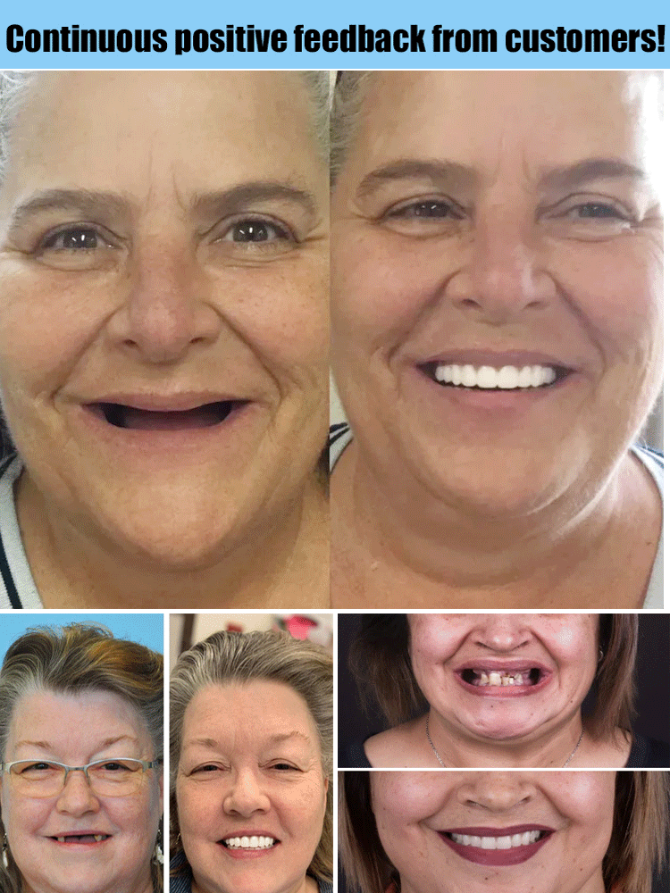🔥 QIAWI™ Dentures Now Buy 2, Get 1 FREE 🛒