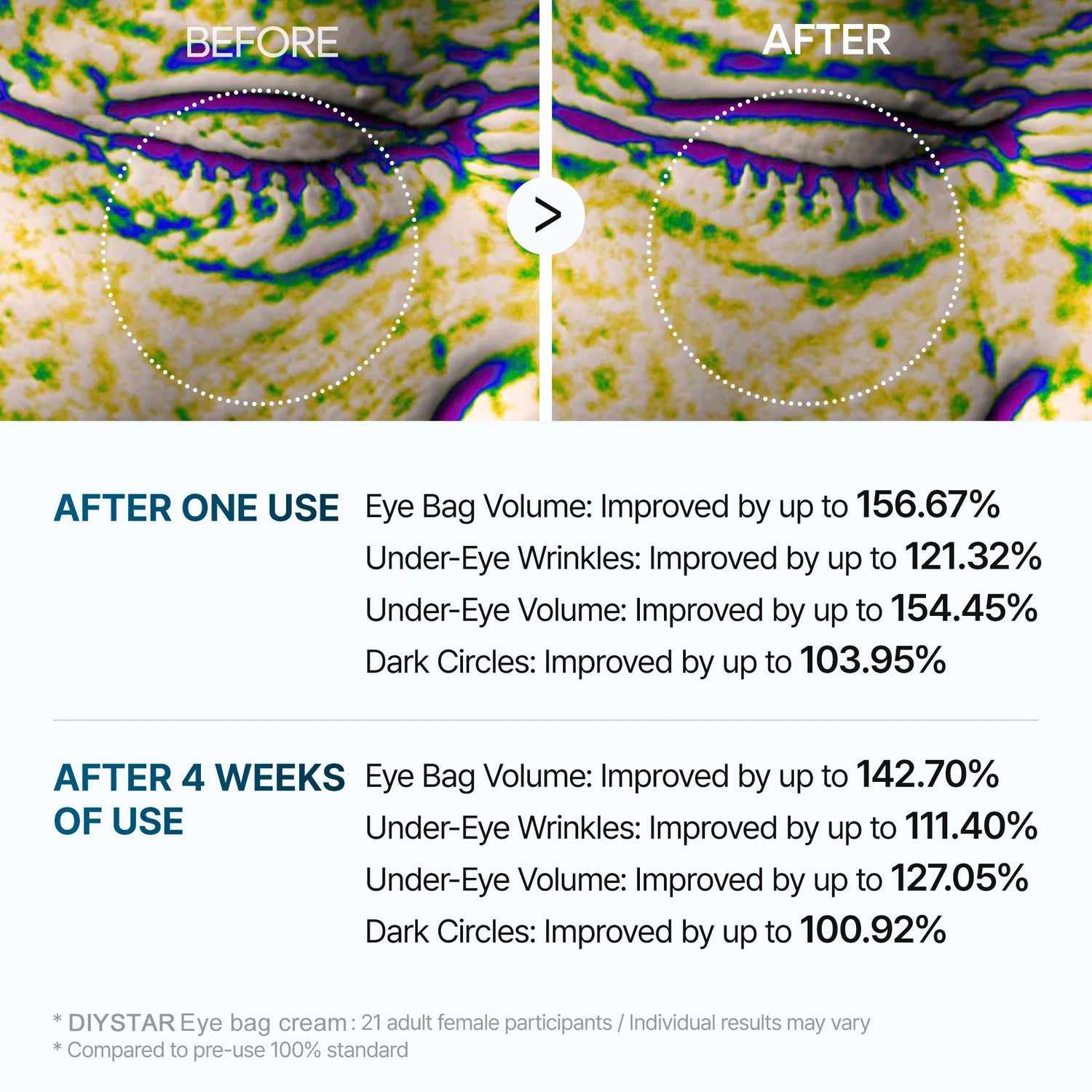 Eye bag cream image Eye bag cream