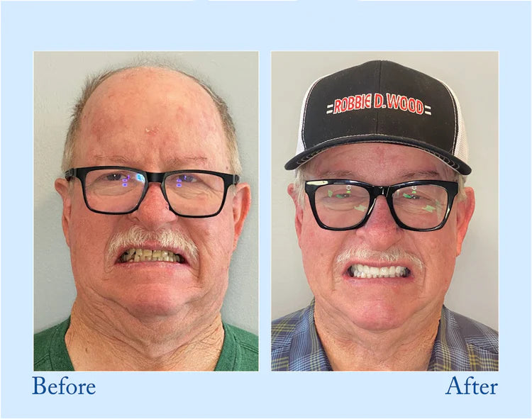 🔥 QIAWI™ Dentures Now Buy 2, Get 1 FREE 🛒