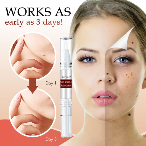 ✨BUY 1 GET 1 FREE✨ Lovilds™ Tags & Moles Remover