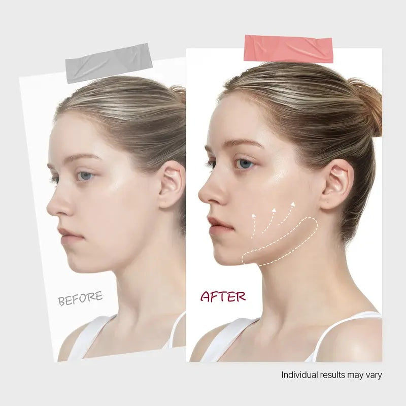🔥70% OFF | LIMITED TIME🔥Wildtidey Camellia Deep Collagen Chin Lifting Gel Mask – Double Chin Reducer, Defined Jawline Shaper, Firming