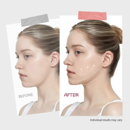 🔥70% OFF | LIMITED TIME🔥Wildtidey Camellia Deep Collagen Chin Lifting Gel Mask – Double Chin Reducer, Defined Jawline Shaper, Firming
