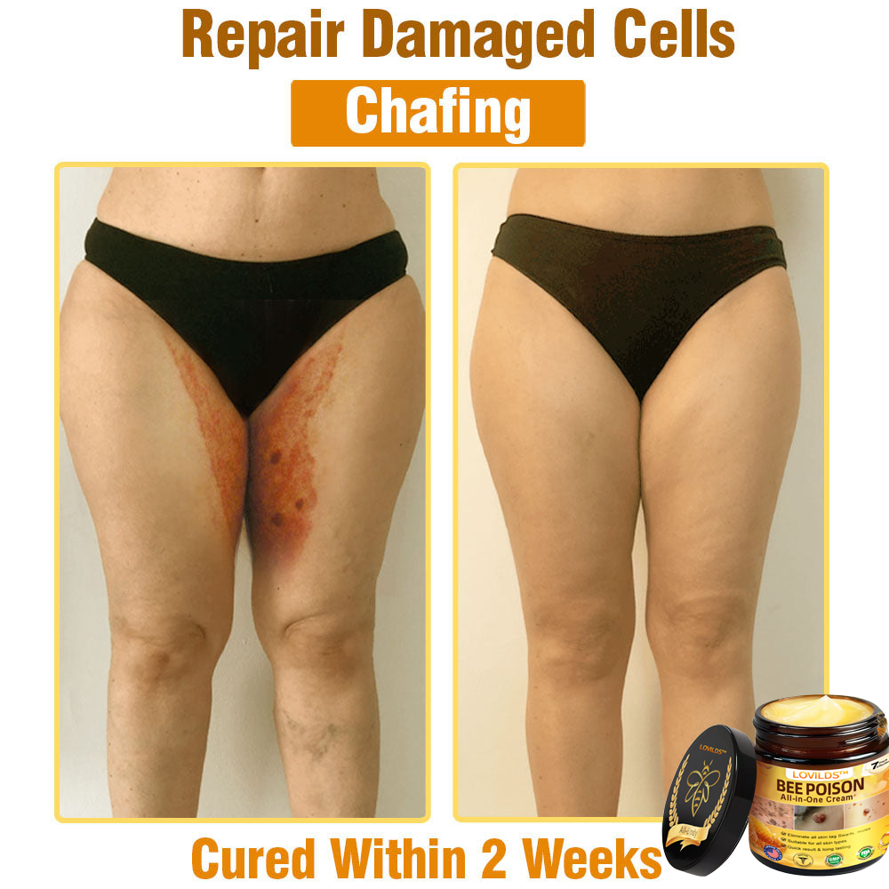 US-Approved Bee Poison Cream for All Skin Concerns