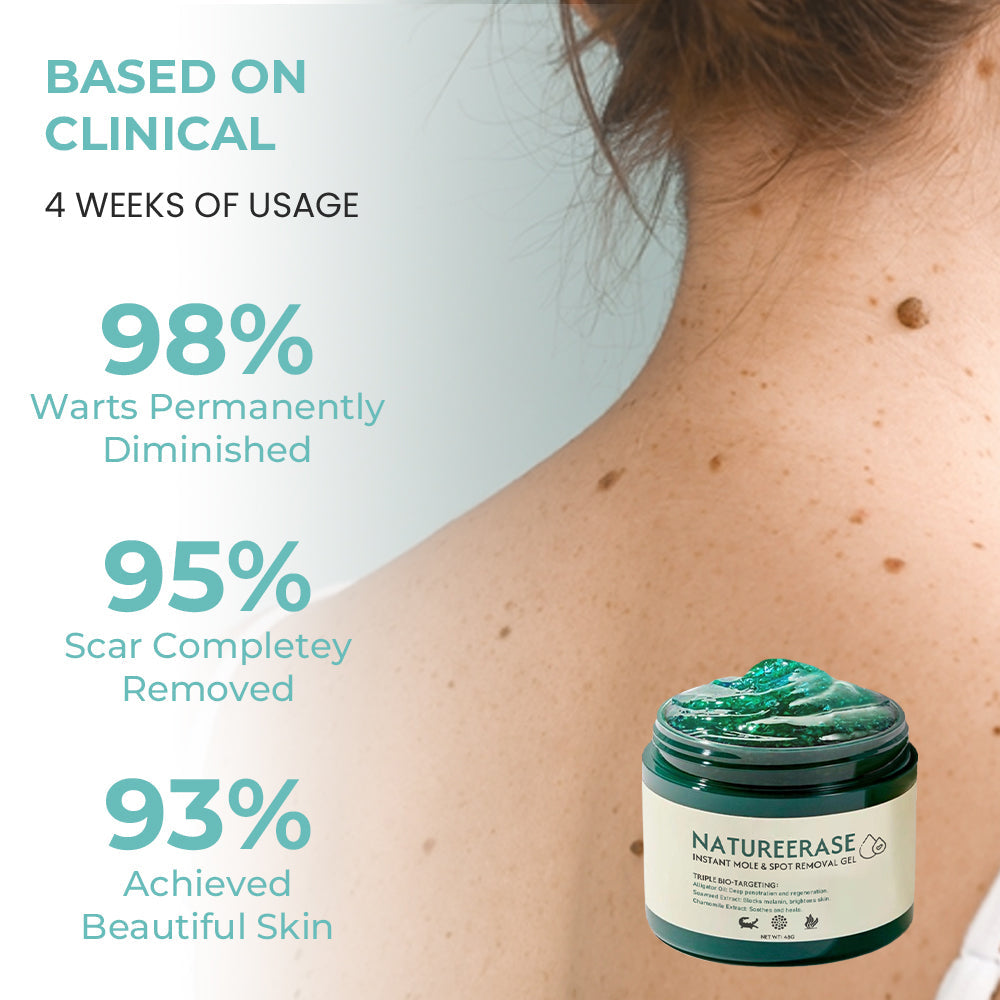 ✅ Official Store:  LOVILDS™ Ultra NatureErase Instant Mole & Spot Removal Gel