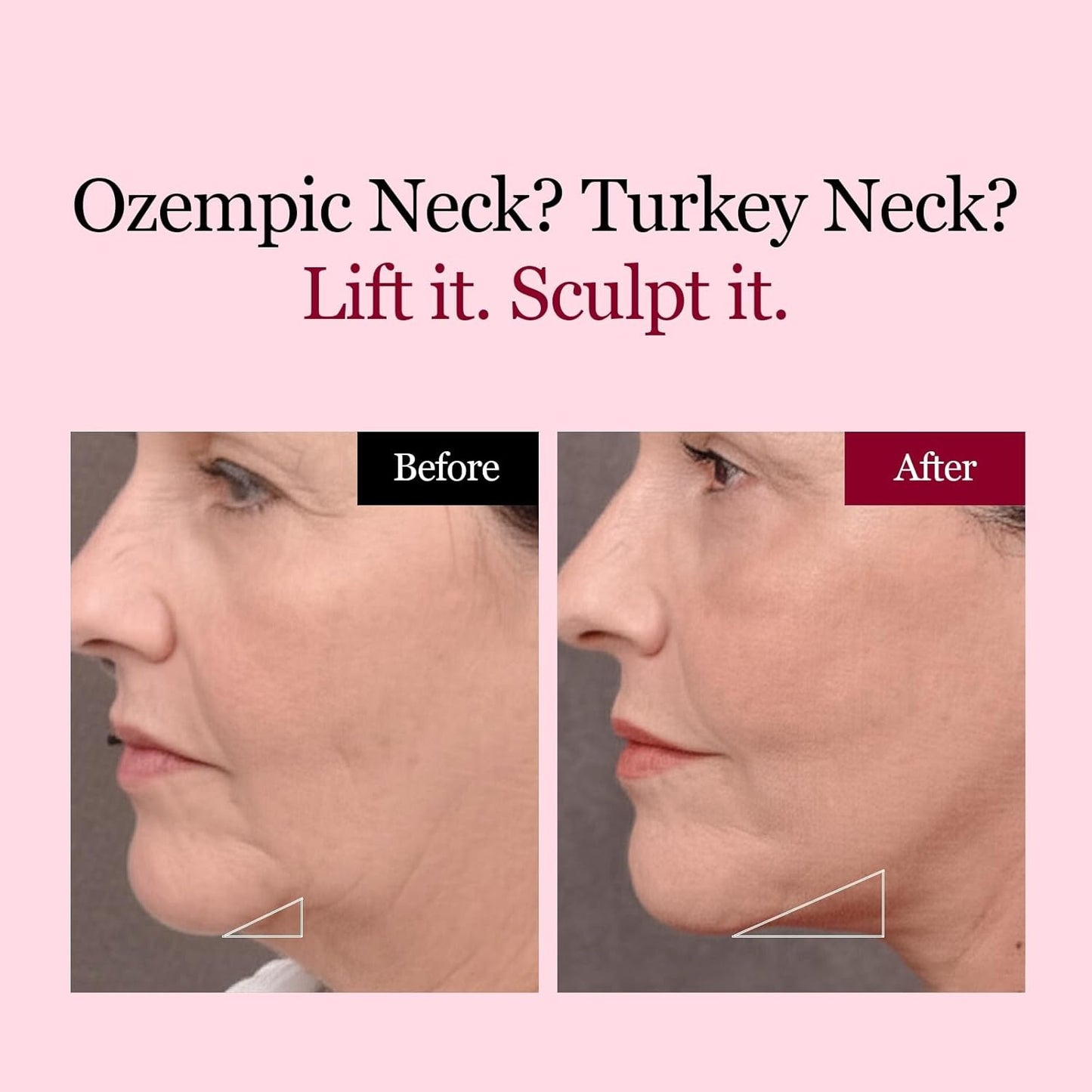 🔥70% OFF | LIMITED TIME🔥Wildtidey Camellia Deep Collagen Chin Lifting Gel Mask – Double Chin Reducer, Defined Jawline Shaper, Firming
