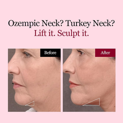 🔥70% OFF | LIMITED TIME🔥Wildtidey Camellia Deep Collagen Chin Lifting Gel Mask – Double Chin Reducer, Defined Jawline Shaper, Firming