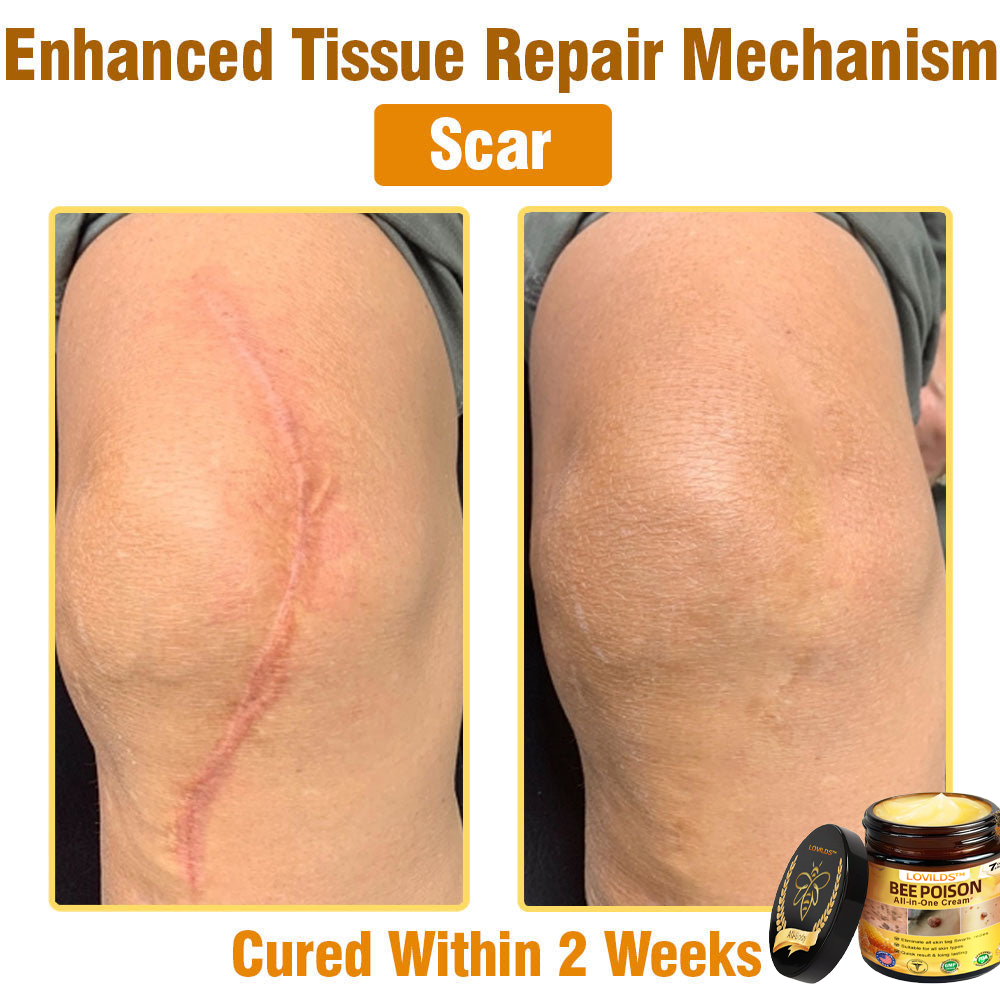 US-Approved Bee Poison Cream for All Skin Concerns