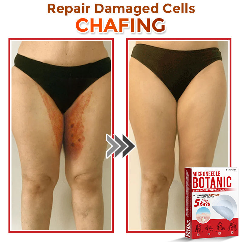 🌈LOVILDS® MicroNeedle Botanic Skin Tag Removal Patch 🇺🇸 Made in the USA