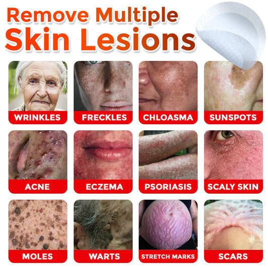 🌈LOVILDS® MicroNeedle Botanic Skin Tag Removal Patch 🇺🇸 Made in the USA