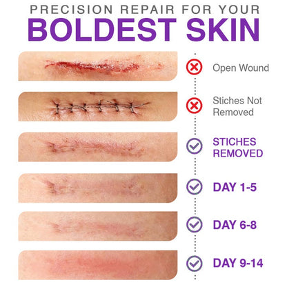 Wildtidey™ 3-in-1 Microneedle Care Patch