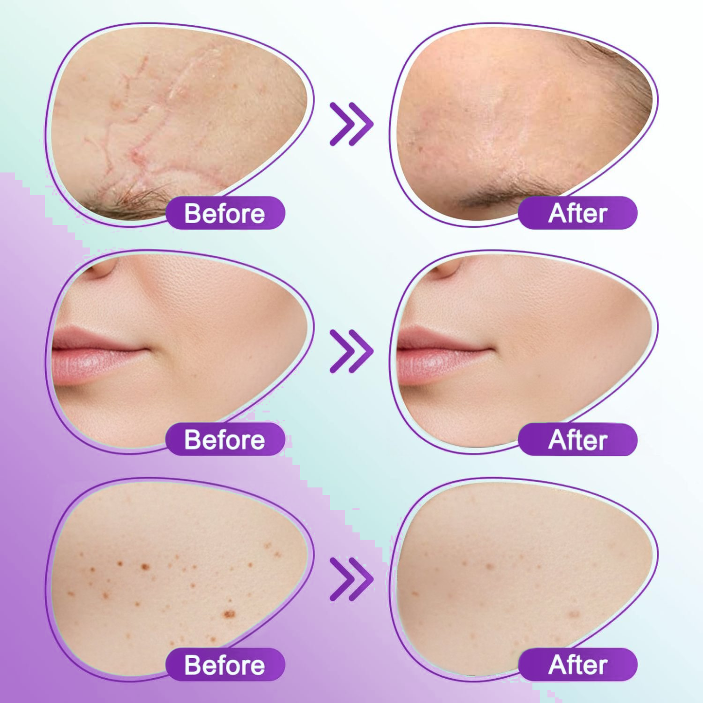 Wildtidey™ 3-in-1 Microneedle Care Patch